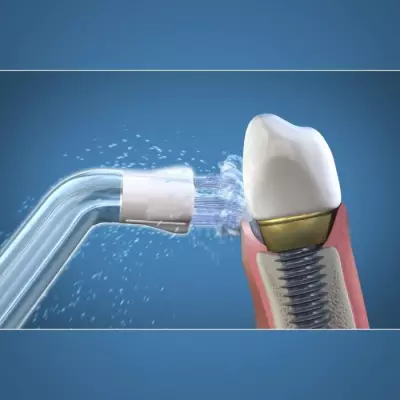Embouts Hydropulseur WATERPIK - Plaque Seeker: Adieu plaque!